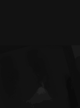 AI-Driven Imaging Analysis