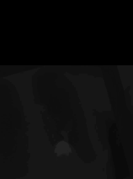 AI-Driven Imaging Analysis