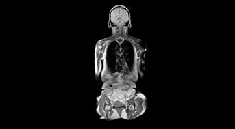 Full-Body MRI
